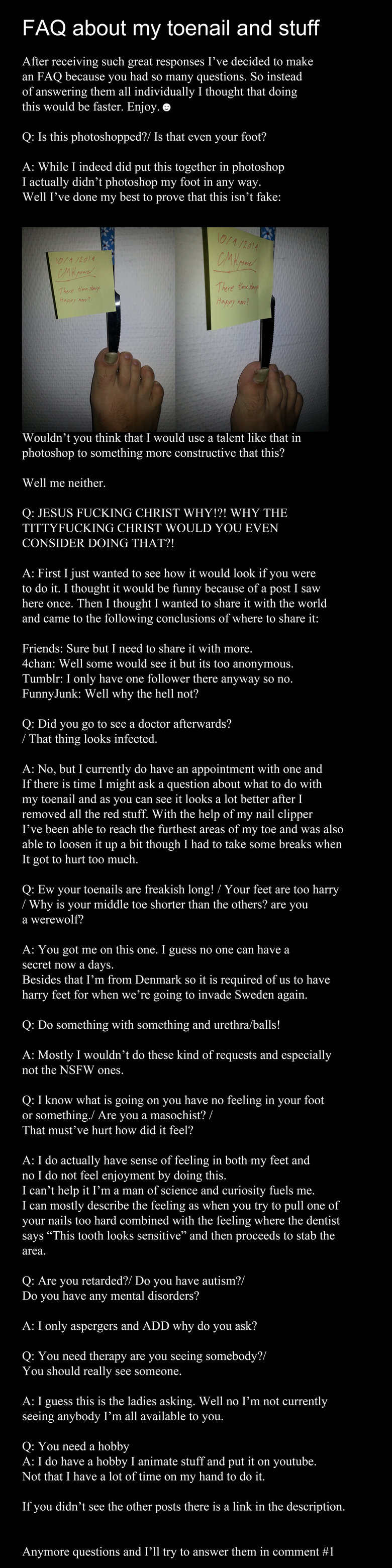 FAQ about my toenail FAQ about my toenail. This time I've decided to answer some of all those questions you had. Links for the previous posts: /channel/morbid-channel/Fun+with+tooth