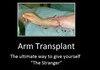 Arm Transplant
