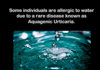 Aquagenic Urticaria