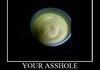 asshole