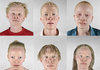 Albino Black People